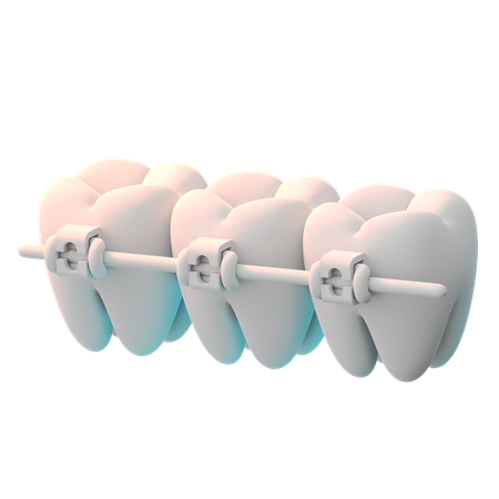 Braces  3D Icon