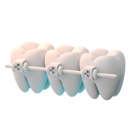 Braces  3D Icon