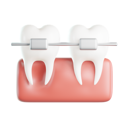 Braces  3D Icon