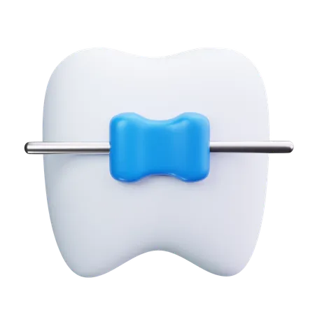 Braces  3D Icon