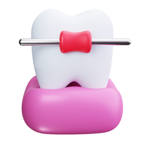 Braces  3D Icon