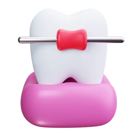 Braces  3D Icon