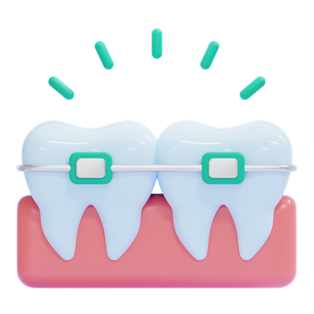 Braces  3D Icon