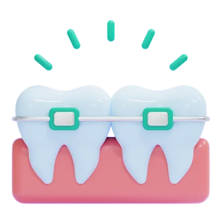 Braces  3D Icon