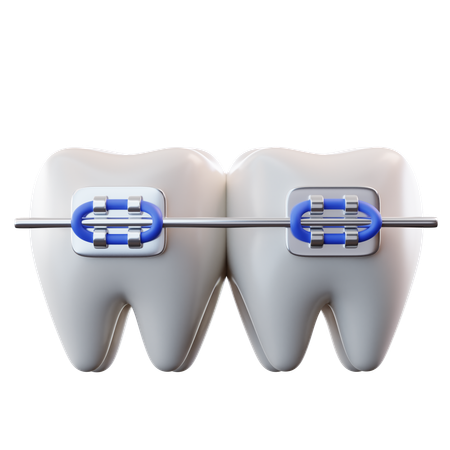 Braces  3D Icon