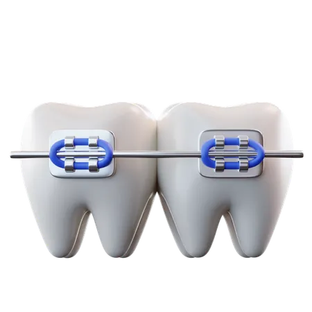 Braces  3D Icon