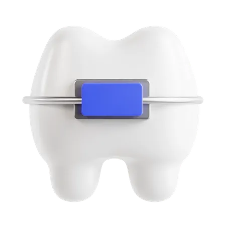 Braces  3D Icon