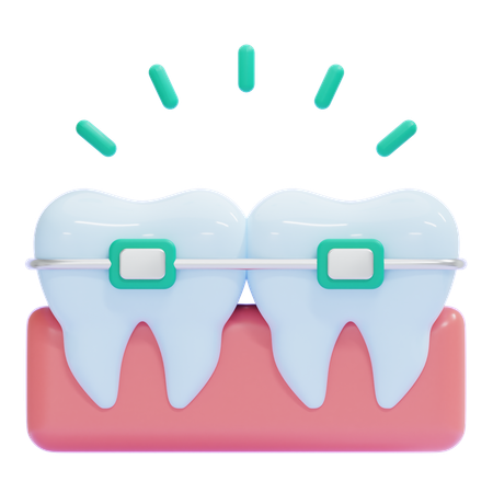Braces  3D Icon