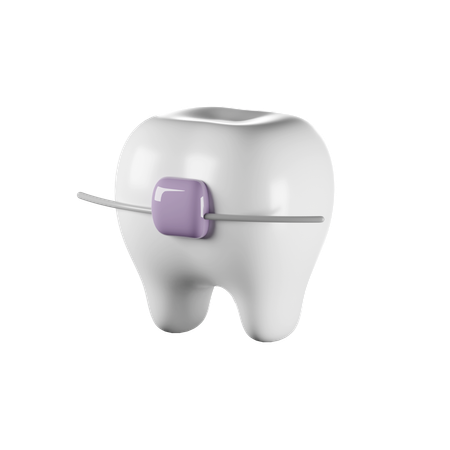 Braces  3D Icon