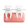 3d braces emoji