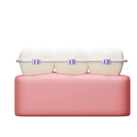 Braces Tooth  3D Icon