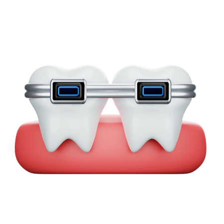 Brackets dentales  3D Icon