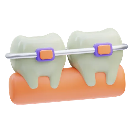 Brackets dentales  3D Icon