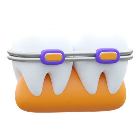 Brackets dentales  3D Icon