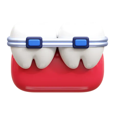 Brackets dentales  3D Icon