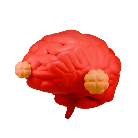 Brain Cancer  3D Icon