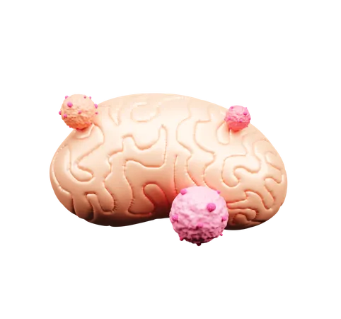 Brain Cancer  3D Icon