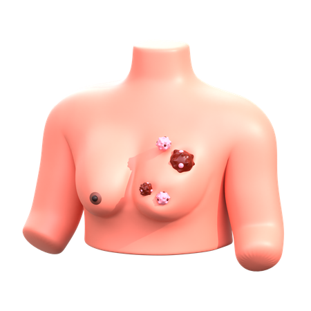 Breast Cancer  3D Icon