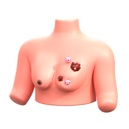 Breast Cancer  3D Icon