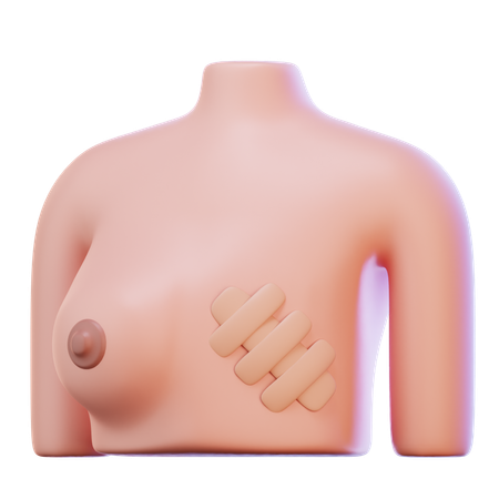 Breast Cancer  3D Icon