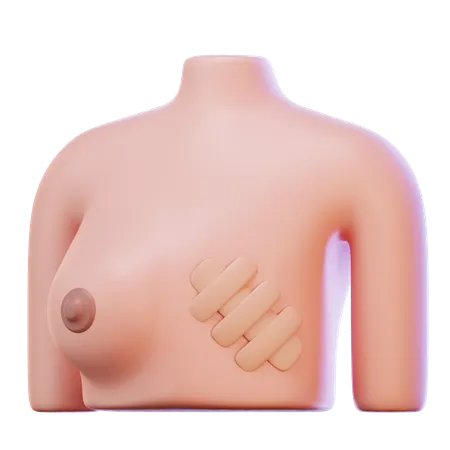 Breast Cancer  3D Icon