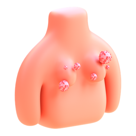 Breast Cancer  3D Icon