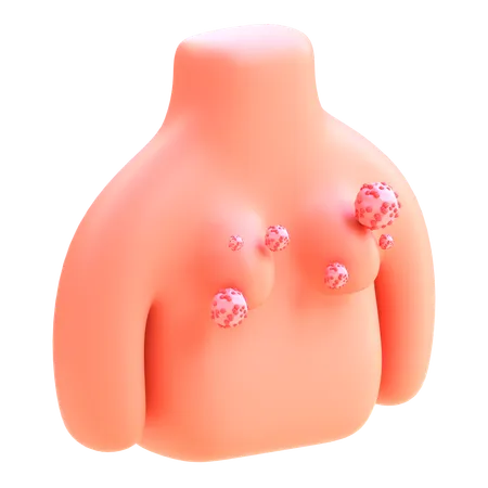 Breast Cancer  3D Icon