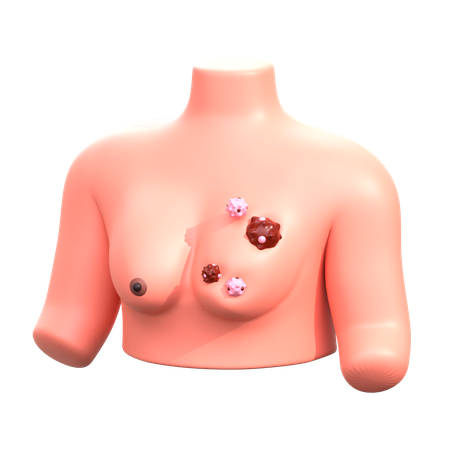 Breast Cancer  3D Icon