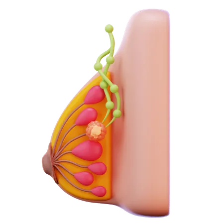 유방암 2기  3D Icon