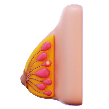 Breast Cancer Stage  3D Icon