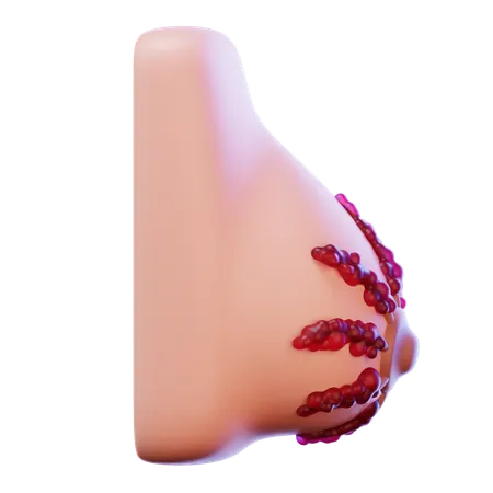 Breast Cancer Stage  3D Icon