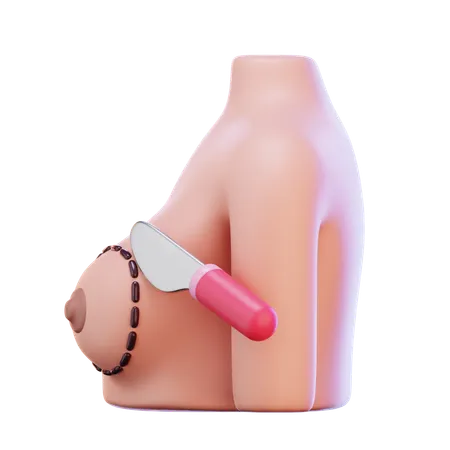 Breast Cancer Surgery  3D Icon