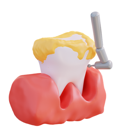 Broca de dente  3D Icon