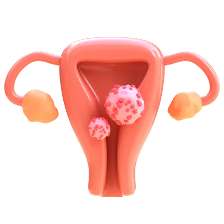 Câncer cervical  3D Icon