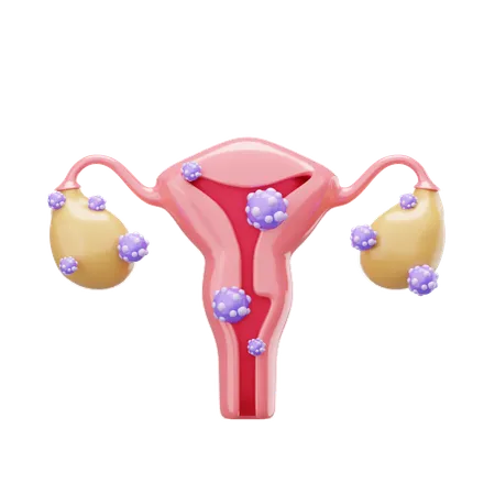 Câncer cervical  3D Icon