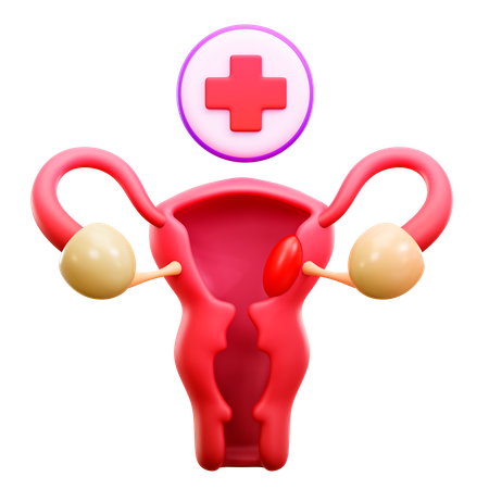 Cáncer de cuello uterino  3D Illustration