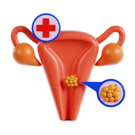Cáncer de cuello uterino  3D Icon