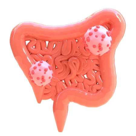 Cancer colorectal  3D Icon