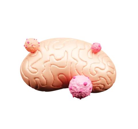 Cáncer de cerebro  3D Icon