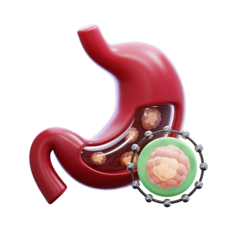 Cáncer de estómago  3D Icon