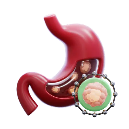 Cáncer de estómago  3D Icon