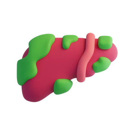 Cáncer de hígado  3D Icon