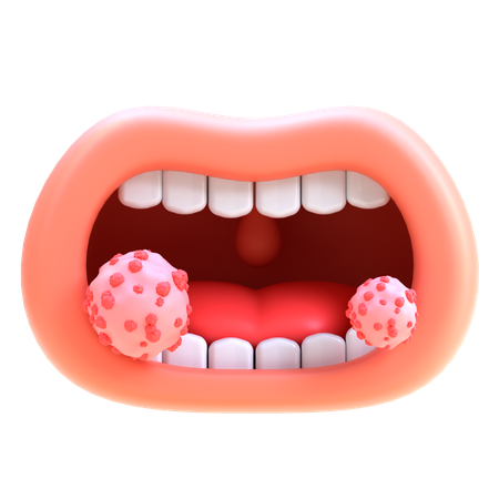 Cancer de la bouche  3D Icon