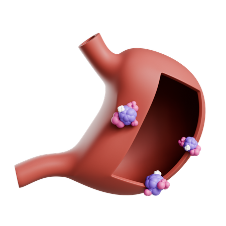 Cancer de l'estomac  3D Icon