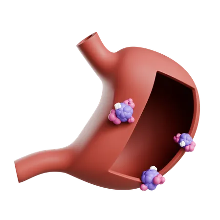 Cancer de l'estomac  3D Icon