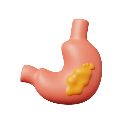 Cancer de l'estomac  3D Icon