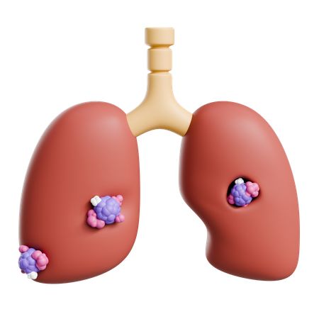 Câncer de pulmão  3D Icon