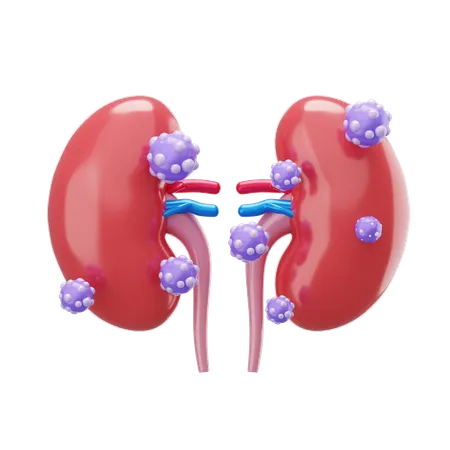Cancer de RIÑON  3D Icon