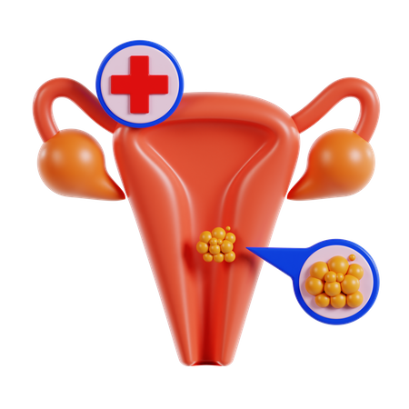Cancer du col de l'utérus  3D Icon