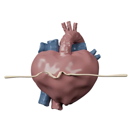 Cardiac Arrest  3D Icon